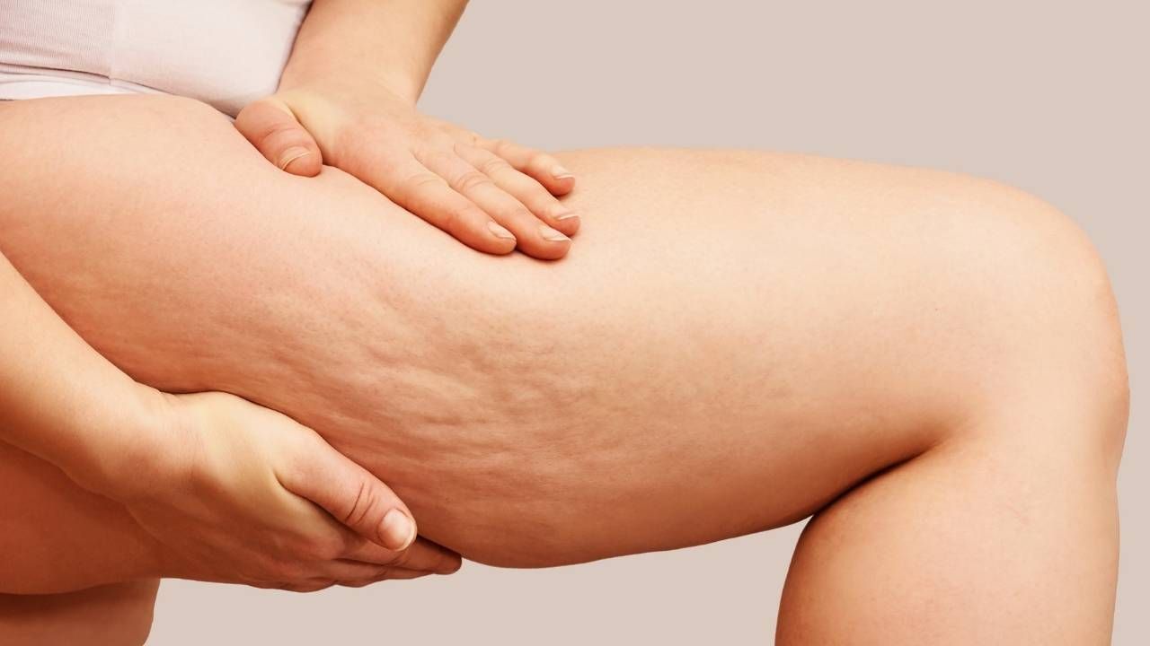 metodi addio cellulite