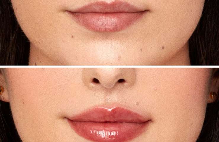 Applicazione lip plumper