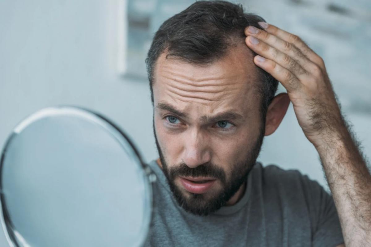 Uomo perde i capelli